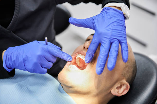 Best Emergency Denture Repair in Eldorado, IL