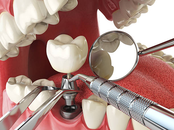 Best Same-Day Emergency Dental Services in Eldorado, IL