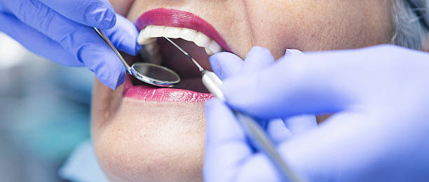 Best Emergency Treatment for Dental Infections or Abscesses in Eldorado, IL