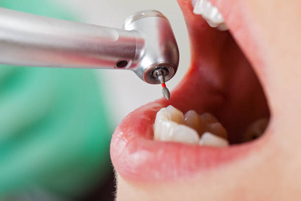 Best Cosmetic Emergency Dentistry in Eldorado, IL
